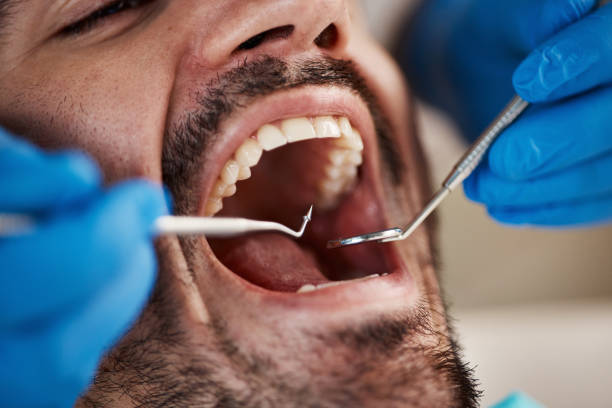 Best Pediatric Emergency Dentist in Hazen, ND